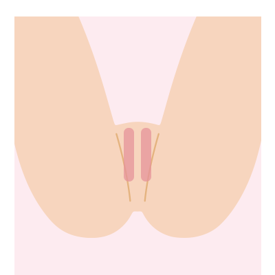 Ｉライン